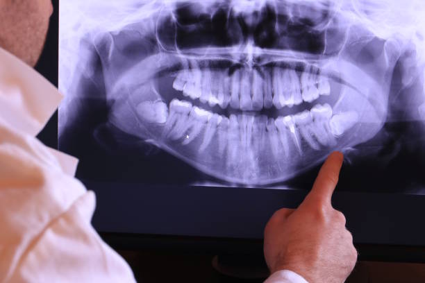 Best Emergency Dental Surgery in Minersville, PA